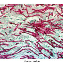 PAS Stain Kit Small Intestine Control Slides ,Pack oF 25 - Axiom Medical Supplies