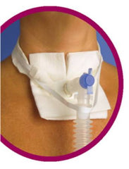 Pepper Medical Ventilator Anti-disconnect Device / Tracheostomy Tube Neckband Vent-Tie®