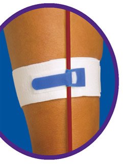 Pepper Medical Catheter Holder Foley-Tie® Velcro, Blue