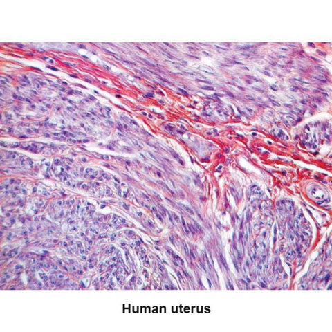 PTAH Stain Kit 100mL Kit ,1 Each - Axiom Medical Supplies