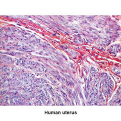 PTAH Stain Kit 100mL Kit ,1 Each - Axiom Medical Supplies