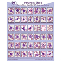 Peripheral Blood Cards and Posters Normal White Blood Cell &amp; Platelet Morphology ,1 Each - Axiom Medical Supplies