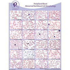 Peripheral Blood Cards and Posters Platelet Morph &amp; Microorganisms Cards ,10 / pk - Axiom Medical Supplies