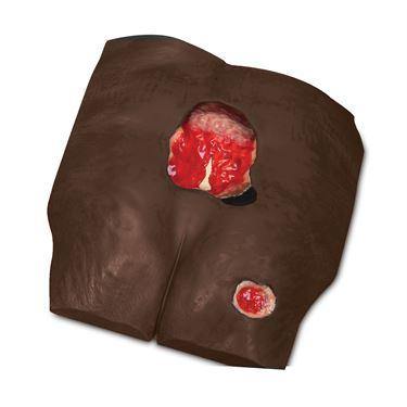 Stan Stage 4 Pressure Injury Model Stan Stage 4 Pressure Injury Model ,1 Each - Axiom Medical Supplies