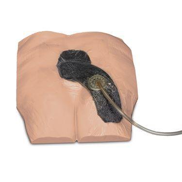 Stan Stage 4 Pressure Injury Model Stan Stage 4 Pressure Injury Model ,1 Each - Axiom Medical Supplies