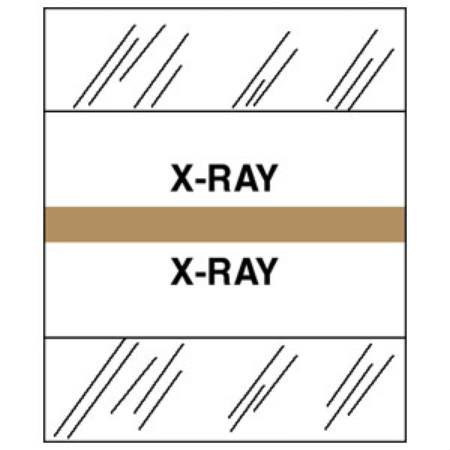 Tabbies Index Tab 1 1/4 Inch X-Ray