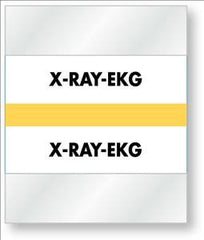 United Ad Label Pre-Printed Label Laboratory Use White Fluorescent Paper X-Ray Ekg Black Lab / Specimen 1-1/2 X 1-1/4 Inch - M-720828-3593 - Pack of 100