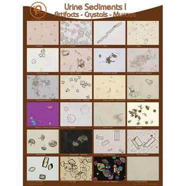 Urine Sediments Posters and Binder Cards Student Binder Cards II • 8.5"W x 11"H ,10 / pk - Axiom Medical Supplies