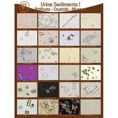 Urine Sediments Posters and Binder Cards Student Binder Cards I • 8.5"W x 11"H ,10 / pk - Axiom Medical Supplies