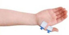 Natus Medical Tab Electrode Kit - M-500746-3467 - Each