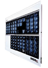 Wolf X-Ray X-Ray Illuminator Trimline Plus 2 Bank 1 Tier 4 Lamp Wall Mount 28 W X 22 H X 3-1/4 D Inch White Two, 17 L X 14 W Inch Film