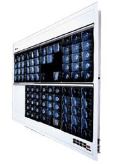 Wolf X-Ray X-Ray Illuminator Trimline Plus 3 Bank 1 Tier 4 Lamp Wall Mount 42 W X 22 H X 3-1/4 D Inch White Three, 17 L X 14 W Inch Film