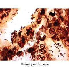 Warthin-Starry Stain Kit Legionella Pneumophila Control Slides ,Pack oF 25 - Axiom Medical Supplies