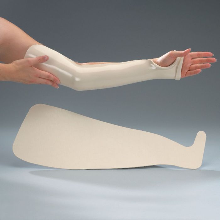 Arm Posterior Splint at Carl Eason blog